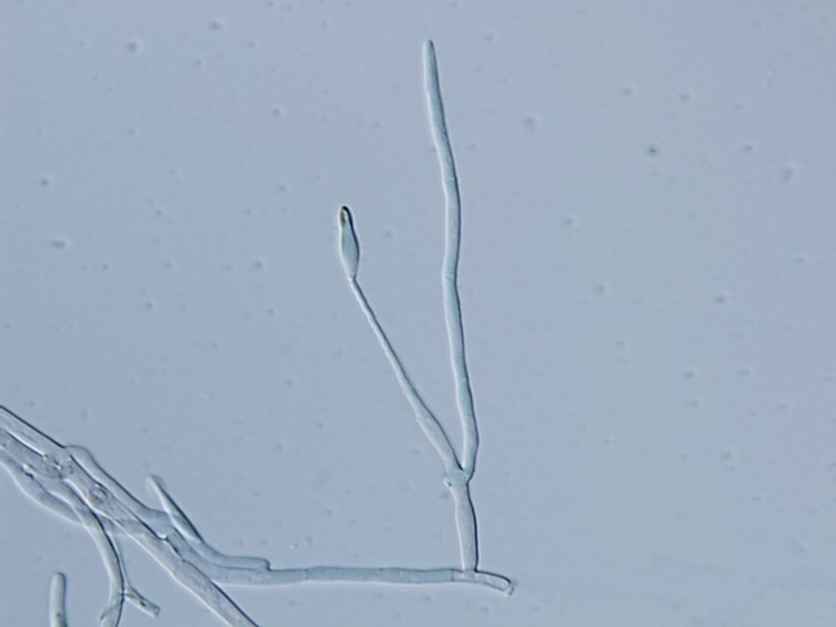 Ophiocordyceps brunneirubra